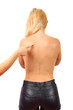 © Sandra - Female hand shows big birthmark on the female back