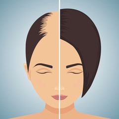 Front view portrait of a woman with alopecia before and after hair treatment and transplantation. Divided image of the head. Two halves. Health care and beauty concept. Vector illustration.