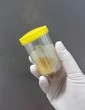 © Sirikwan - Closeup female hand in white disposable latex glove which holding the urine/body fluid specimen container, selective focus.