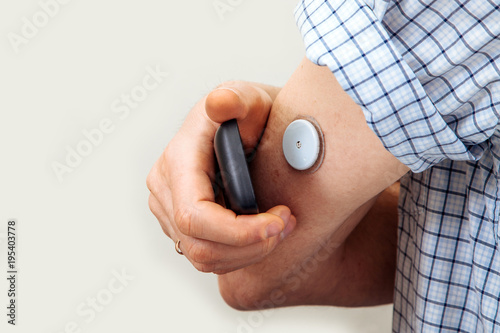 Fotomural sensor diabetes checkup glucose man system sugar monitoring scan test hand skin