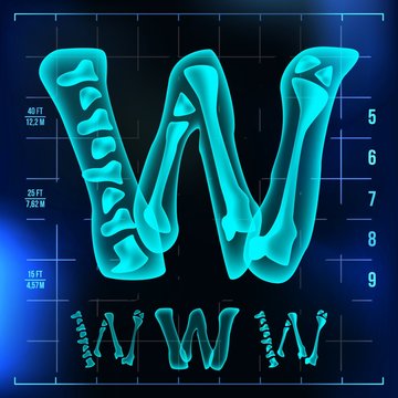W Letter Vector. Capital Digit. Roentgen X-ray Font Light Sign. Medical Radiology Neon Scan Effect. Alphabet. 3D Blue Light Digit With Bone. Medical, Hospital, Futuristic, Horror Style. Illustration