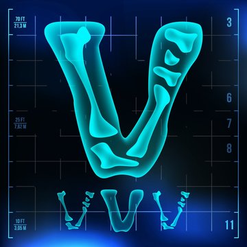 V Letter Vector. Capital Digit. Roentgen X-ray Font Light Sign. Medical Radiology Neon Scan Effect. Alphabet. 3D Blue Light Digit With Bone. Medical, Hospital, Futuristic, Horror Style. Illustration