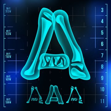 A Letter Vector. Capital Digit. Roentgen X-ray Font Light Sign. Medical Radiology Neon Scan Effect. Alphabet. 3D Blue Light Digit With Bone. Medical, Hospital, Futuristic, Horror Style. Illustration
