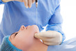 procedure for laser lipolysis of the chin or laser liposuction
