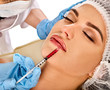 © Gennadiy Poznyakov - Filler injection for female forehead face. Plastic aesthetic facial surgery in beauty clinic. Doctor in medical gloves with syringe injects lips augmentation. Bottox injections.