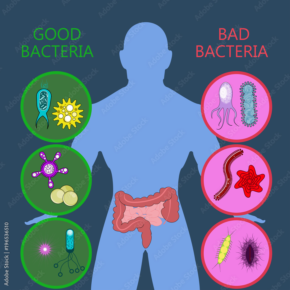 Medical infographic. Intestinal flora gut health vector concept with ...