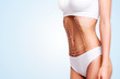 Female body cosmetic surgery and skin liposuction.