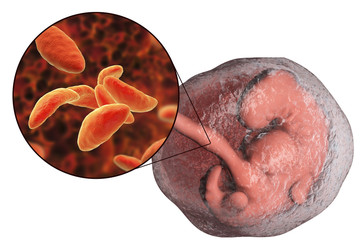 Sticker - Transplacental transmission of Toxoplasma gondii parasites to human embryo, medical concept, 3D illustration