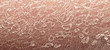  human skin epidermis texture with flaking and cracked particles close-up
