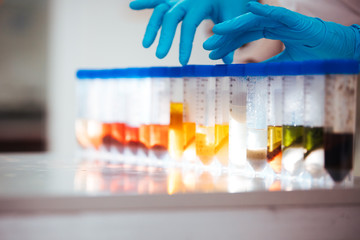 Wall Mural - hand of a scientist taking a food samples in tubes in a laboratory
