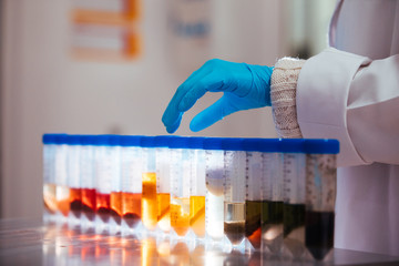 Wall Mural - hand of a scientist taking a food samples in tubes in a laboratory