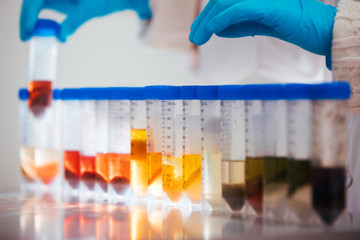 Wall Mural - hand of a scientist taking a food samples in tubes in a laboratory