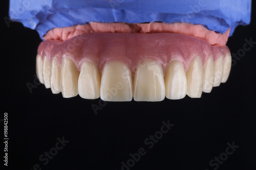 Fotomural high-quality dental prosthesis made of plastic, the upper part of the jaw on a b