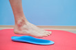 Foot on orthopedic insoles medical foot correction
