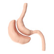 3d rendered medically accurate illustration of a vertical sleeve gastrectomy