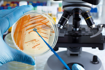 Wall Mural - hand of technician holding plate with bacterial colonies of Streptococcus agalactiae and microscope in background / Colonies of bacteria Streptococcus agalactiae in culture medium plate 