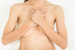 Breast Cancer Surgery in woman