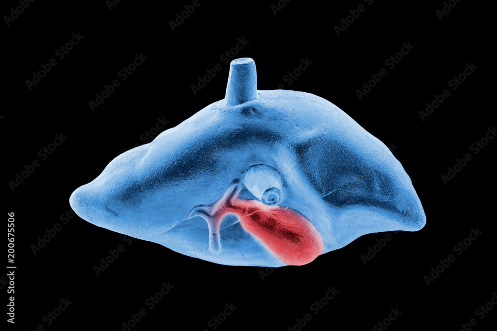 3D x-ray of a human liver and gallbladder cancer. Part of anatomy human ...