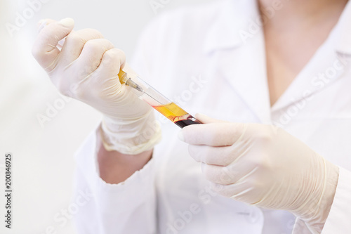 Fotomural the uncertain doctor in medical gloves gathers in syringe plasma from test tube