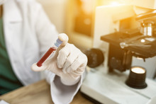 Hand Of A Lab Technician Or Medical Doctor Holding Blood Tube Test And Background A Rack Of Color Tubes  And Microscope With Blood Samples Other Patients In Laboratory