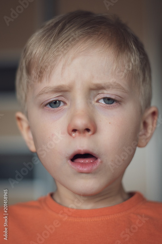 Fotografie, Obraz Five years old boy with allergy runny nose and glazed eyes.