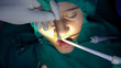 © zefart - Oral surgery operation,cist apicoectomy, dark operation room