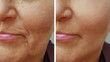 face of an old wrinkle woman before and after