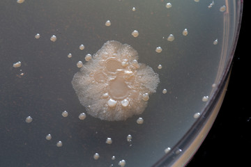 Wall Mural - Colonies of bacteria grown on agar plate