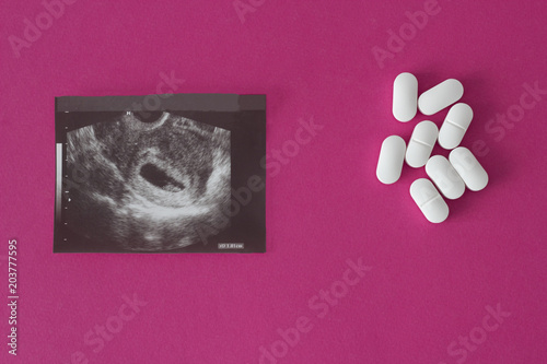 Photographie Uzi of pregnancy on a pink background and pills, abortion.