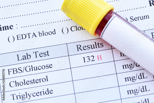 Blood Sample With Abnormal High Blood Sugar Test Result Stock Photo Adobe Stock Blood Sample With Abnormal High Blood Sugar Test Result Stock Photo Adobe Stock