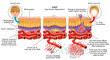 medical vector illustration of symptoms of AMD (age macular degeneration)