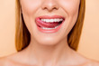 © deagreez - Closeup cropped half face shot of femenine gorgeous playful charming adorable nude natural lady with white healthy teeth gesturing showing tongue out isolated on beige background, correction concept