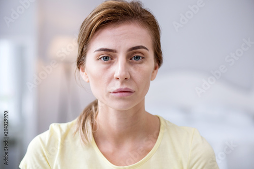 Fotografía Hair loss. Tuft if hair being in hands of a depressed ill woman