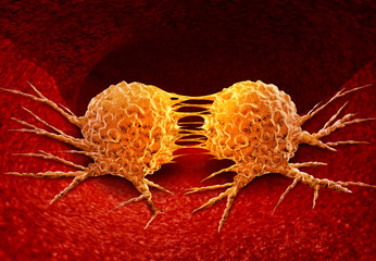 Wall Mural - dividing cancer cell