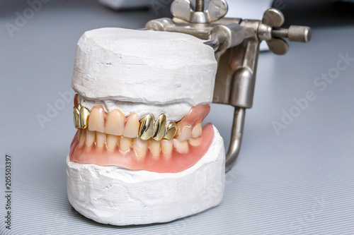 model of teeth with clay