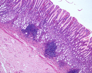 Sticker - Gastric mucosa. Pyloric region