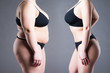 © staras - Woman's body before and after weight loss