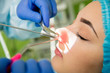 Endoscopic sinus surgery. Laser vaporization of nasal concha