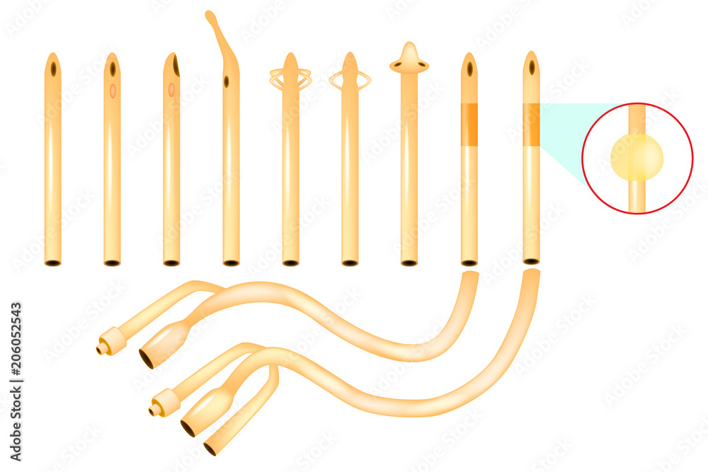 Types of Urinary Catheters. Catheter tips Stock Vector | Adobe Stock