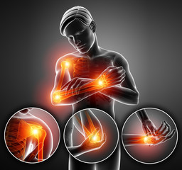 Poster - 3d Illustration of Men Feeling Arm joint pain