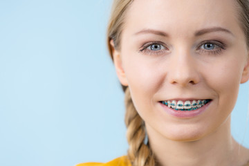 Wall Mural - Woman showing her teeth with braces