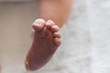© Alison Winterroth Photography/Stocksy - A Baby With Curled Toes And A Bandage On Her Heel