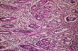 © defun/Stocksy - human stomach gastric mucosa intestinal metaplasia