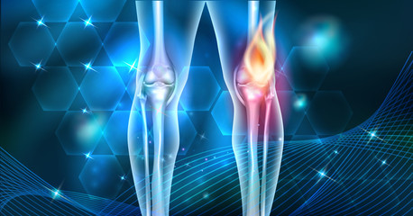 Poster - Knee pain abstract joint burning design