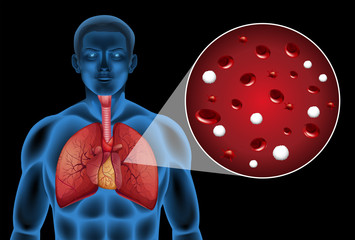 Poster - Magnified cells on lungs