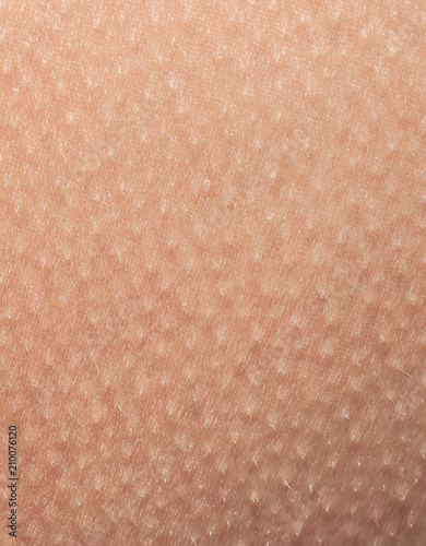 Fotografía human skin covered with small goosebumps of cold and fright close-up