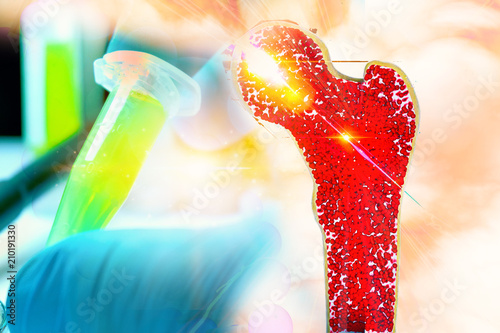 Fotomural Bone research concept bone cancer and stem cells treatment Osteoporosis Bone mar