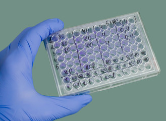 A blue-gloved hand holds a medical plate. Plate with the results of the experiment in the hand of the scientist.