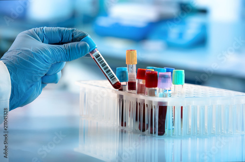 Fotografía Technician holding blood tube test in the research laboratory / doctor hand taki