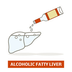 Wall Mural - Alcoholic fatty liver